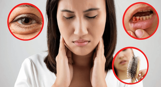 Trao đổi nước và chất dinh dưỡng ở động vật (KHTN 7 Kết nối tri thức Bài 31)