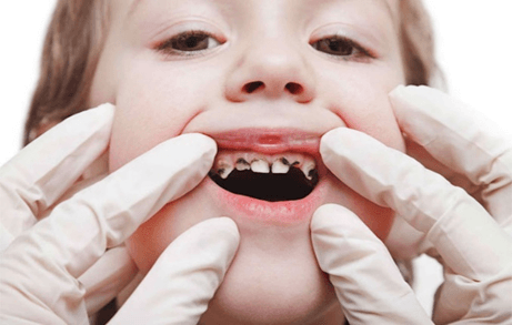 Trao đổi nước và chất dinh dưỡng ở động vật (KHTN 7 Kết nối tri thức Bài 31)