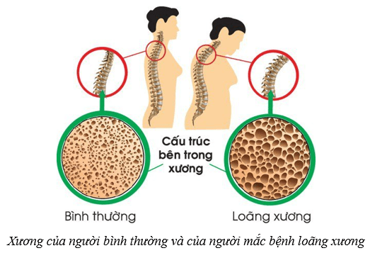 Hệ vận động ở người (KHTN 8 Kết nối tri thức Bài 31)