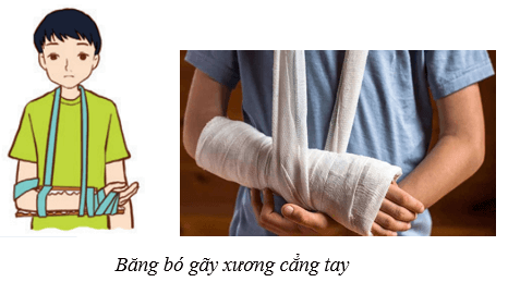 Hệ vận động ở người (KHTN 8 Kết nối tri thức Bài 31)