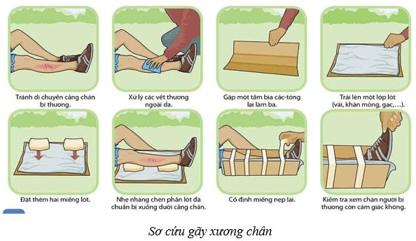 Hệ vận động ở người (KHTN 8 Kết nối tri thức Bài 31)