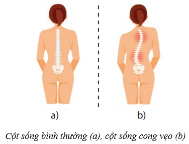 Hệ vận động ở người (KHTN 8 Kết nối tri thức Bài 31)