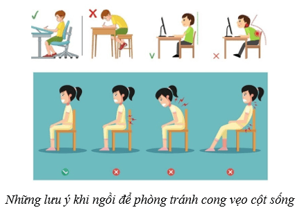 Hệ vận động ở người (KHTN 8 Kết nối tri thức Bài 31)