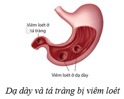 Dinh dưỡng và tiêu hóa ở người (KHTN 8 Kết nối tri thức Bài 32)