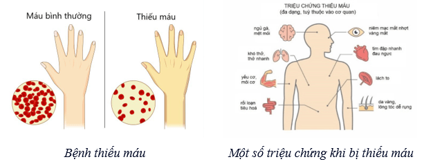 Máu và hệ tuần hoàn của cơ thể người (KHTN 8 Kết nối tri thức Bài 33)
