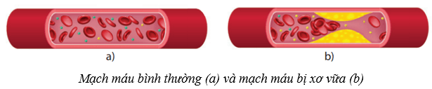 Máu và hệ tuần hoàn của cơ thể người (KHTN 8 Kết nối tri thức Bài 33)
