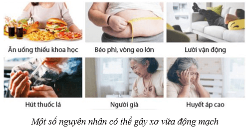 Máu và hệ tuần hoàn của cơ thể người (KHTN 8 Kết nối tri thức Bài 33)