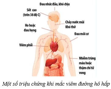 Hệ hô hấp ở người (KHTN 8 Kết nối tri thức Bài 34)