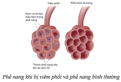 Hệ hô hấp ở người (KHTN 8 Kết nối tri thức Bài 34)