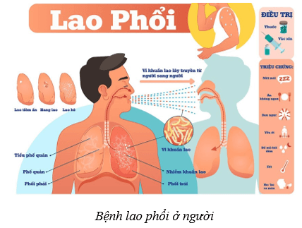 Hệ hô hấp ở người (KHTN 8 Kết nối tri thức Bài 34)