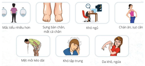 Hệ bài tiết ở người (KHTN 8 Kết nối tri thức Bài 35)