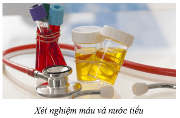 Điều hòa môi trường trong của cơ thể người (KHTN 8 Kết nối tri thức Bài 36)