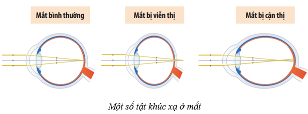 Hệ thần kinh và các giác quan ở người (KHTN 8 Kết nối tri thức Bài 37)
