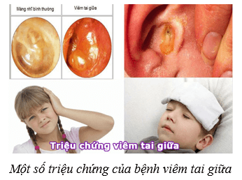 Hệ thần kinh và các giác quan ở người (KHTN 8 Kết nối tri thức Bài 37)