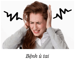 Hệ thần kinh và các giác quan ở người (KHTN 8 Kết nối tri thức Bài 37)