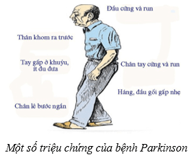 Hệ thần kinh và các giác quan ở người (KHTN 8 Kết nối tri thức Bài 37)