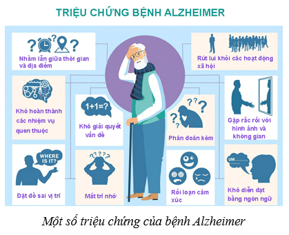 Hệ thần kinh và các giác quan ở người (KHTN 8 Kết nối tri thức Bài 37)