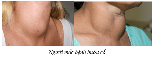 Hệ nội tiết ở người (KHTN 8 Kết nối tri thức Bài 38)