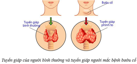 Hệ nội tiết ở người (KHTN 8 Kết nối tri thức Bài 38)