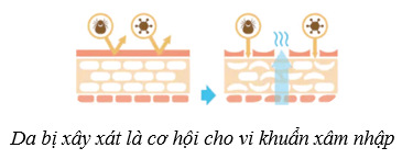 Da và điều hòa thân nhiệt ở người (KHTN 8 Kết nối tri thức Bài 39)