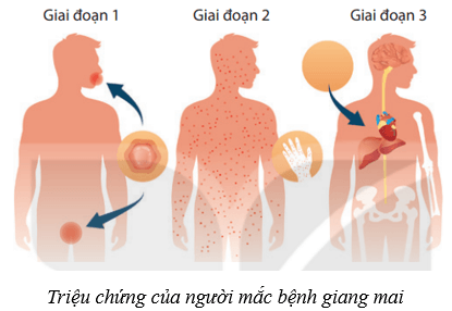 Sinh sản ở người (KHTN 8 Kết nối tri thức Bài 40)