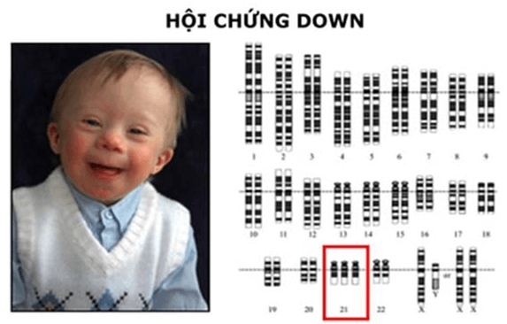 Đột biến nhiễm sắc thể (KHTN 9 Kết nối tri thức Bài 46)