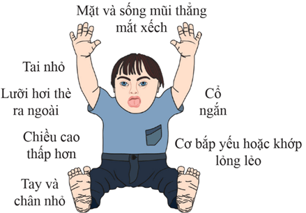 Di truyền học với con người (KHTN 9 Kết nối tri thức Bài 47)