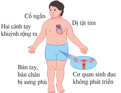 Di truyền học với con người (KHTN 9 Kết nối tri thức Bài 47)