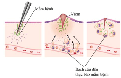 Cơ chế tiêu diệt mầm bệnh của tế bào thực bào