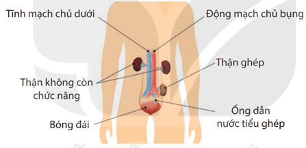Một số triệu chứng khi mắc bệnh suy thận