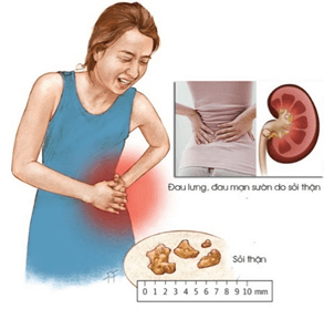 Sơ đồ chạy thận nhân tạo