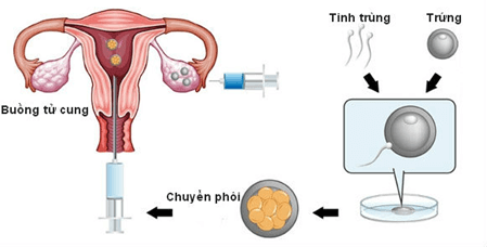 Thụ tinh nhân tạo bên ngoài cơ thể ở cá