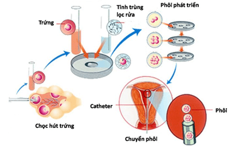 Chiếu tia tử ngoại lên tằm sẽ tạo ra nhiều tằm đực